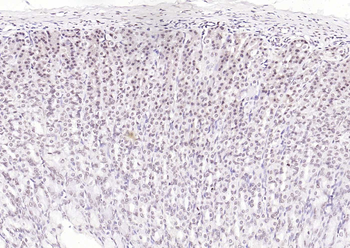 HNF1A Rabbit Polyclonal Antibody