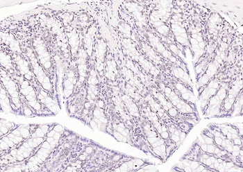 HNF1A Rabbit Polyclonal Antibody