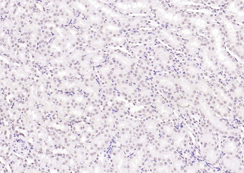 HNF1A Rabbit Polyclonal Antibody