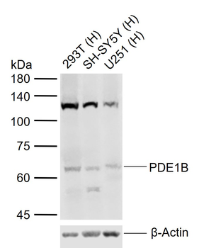 PDE1B Rabbit Polyclonal Antibody