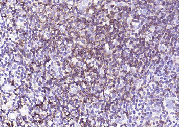 Human CD43 Mouse Monoclonal Antibody