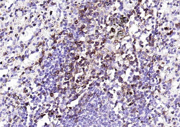 Human CD43 Mouse Monoclonal Antibody