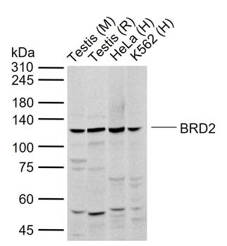 BRD2 Rabbit Polyclonal Antibody