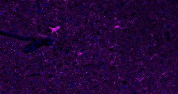 NF-L Rabbit Polyclonal Antibody