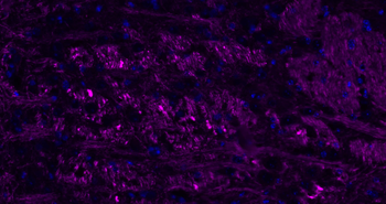 NF-L Rabbit Polyclonal Antibody