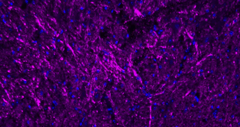 NF-L Rabbit Polyclonal Antibody