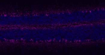 NF-L Rabbit Polyclonal Antibody
