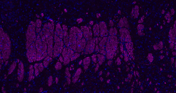 NF-L Rabbit Polyclonal Antibody