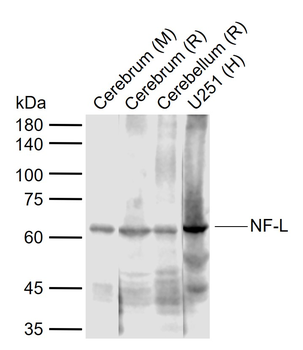 NF-L Rabbit Polyclonal Antibody
