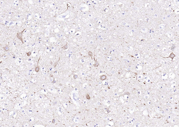 NF-L Rabbit Polyclonal Antibody