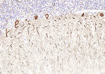 NF-L Rabbit Polyclonal Antibody