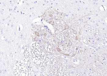 NF-L Rabbit Polyclonal Antibody