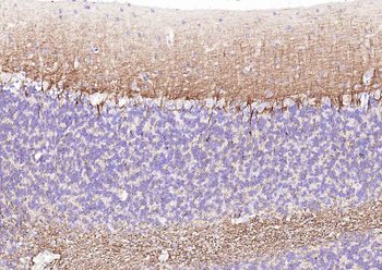 NF-L Rabbit Polyclonal Antibody