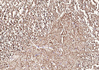 NF-L Rabbit Polyclonal Antibody