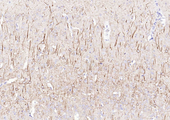 NF-L Rabbit Polyclonal Antibody