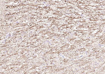 NF-L Rabbit Polyclonal Antibody