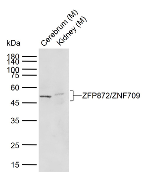 ZFP872/ZNF709 Rabbit Polyclonal Antibody
