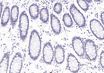 Histone H3 (tri methyl K9) Rabbit Polyclonal Antibody