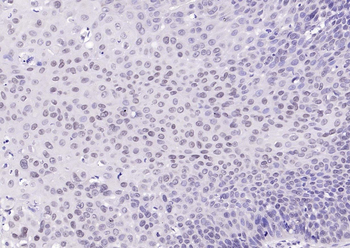 Histone H3 (tri methyl K9) Rabbit Polyclonal Antibody