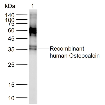 Osteocalcin Mouse Monoclonal Antibody