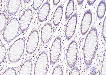 Phospho-STAT3 (Ser727) Rabbit Polyclonal Antibody