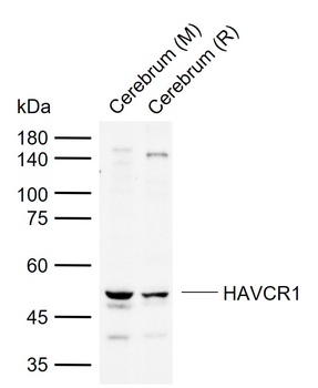 HAVCR1 Rabbit Polyclonal Antibody