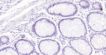 Human TIMP1 Ready-To-Use IHC Kit