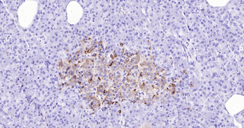 Human TIMP1 Ready-To-Use IHC Kit