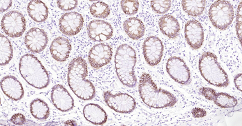 Human ATP1A1 Ready-To-Use IHC Kit