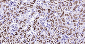 Rat LRP2 Ready-To-Use IHC Kit