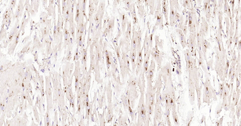 Human LAMP1 Ready-To-Use IHC Kit