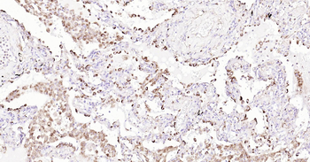 Human LAMP1 Ready-To-Use IHC Kit