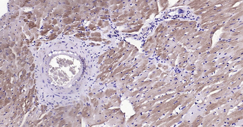 MYL2 Ready-To-Use IHC Kit
