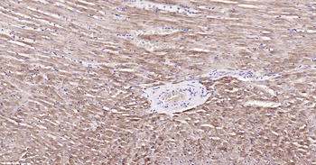 MYL2 Ready-To-Use IHC Kit