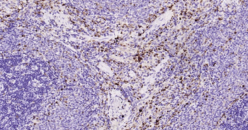 Rat CD68 Ready-To-Use IHC Kit