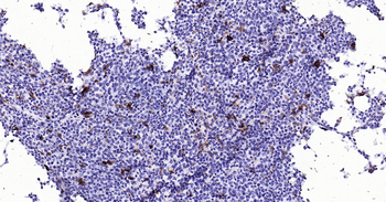 CD68 Ready-To-Use IHC Kit