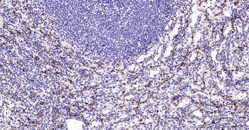CD68 Ready-To-Use IHC Kit