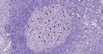 CD68 Ready-To-Use IHC Kit