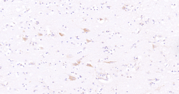 Human SLC44A1 Ready-To-Use IHC Kit