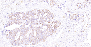 Human SLC44A1 Ready-To-Use IHC Kit