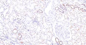 Human SLC44A1 Ready-To-Use IHC Kit