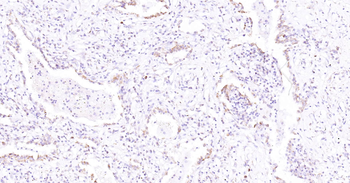 Human SLC44A1 Ready-To-Use IHC Kit