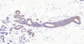 Human Cytokeratin 8 Ready-To-Use IHC Kit