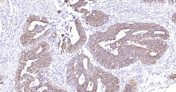 Human Cytokeratin 8 Ready-To-Use IHC Kit