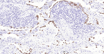 Human Cytokeratin 8 Ready-To-Use IHC Kit