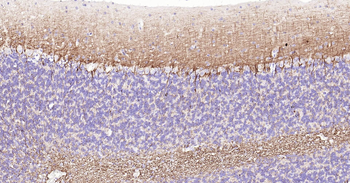 NF-L Ready-To-Use IHC Kit
