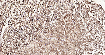 NF-L Ready-To-Use IHC Kit