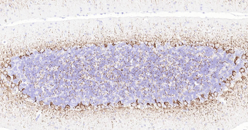 NF-L Ready-To-Use IHC Kit