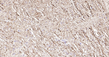 NF-L Ready-To-Use IHC Kit
