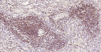 Human CD4 Ready-To-Use IHC Kit
